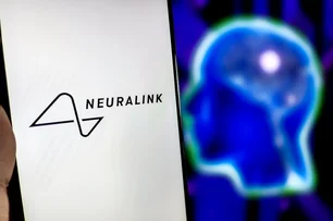 Imagem referente à matéria: Implante cerebral da Neuralink, de Elon Musk, apresenta defeito em paciente