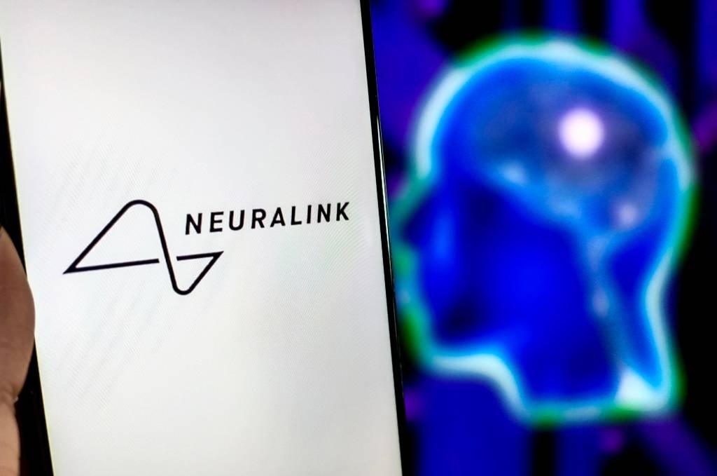 Paciente pioneiro da Neuralink usa implante cerebral para aprender francês e japonês