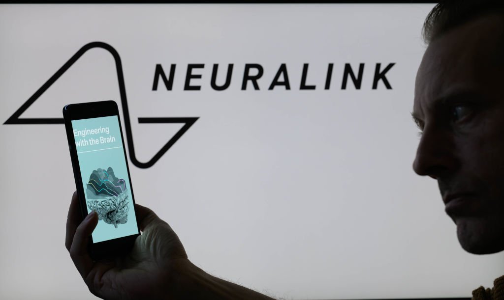 Neuralink realiza segundo implante em paciente com lesão na medula espinhal