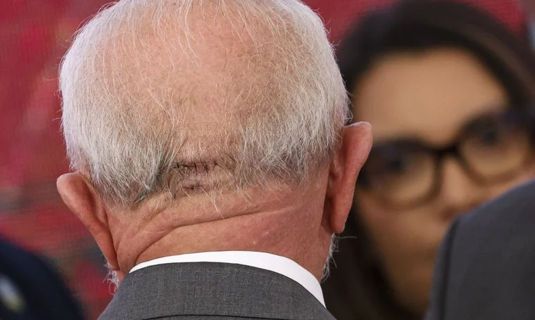 Presidente levou pontos na cabeça após acidente doméstico (Agência Brasil)