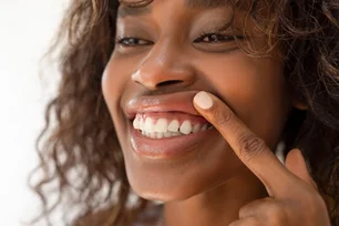 Imagem referente à matéria: Japão testa medicamento que faz crescer dentes perdidos em humanos