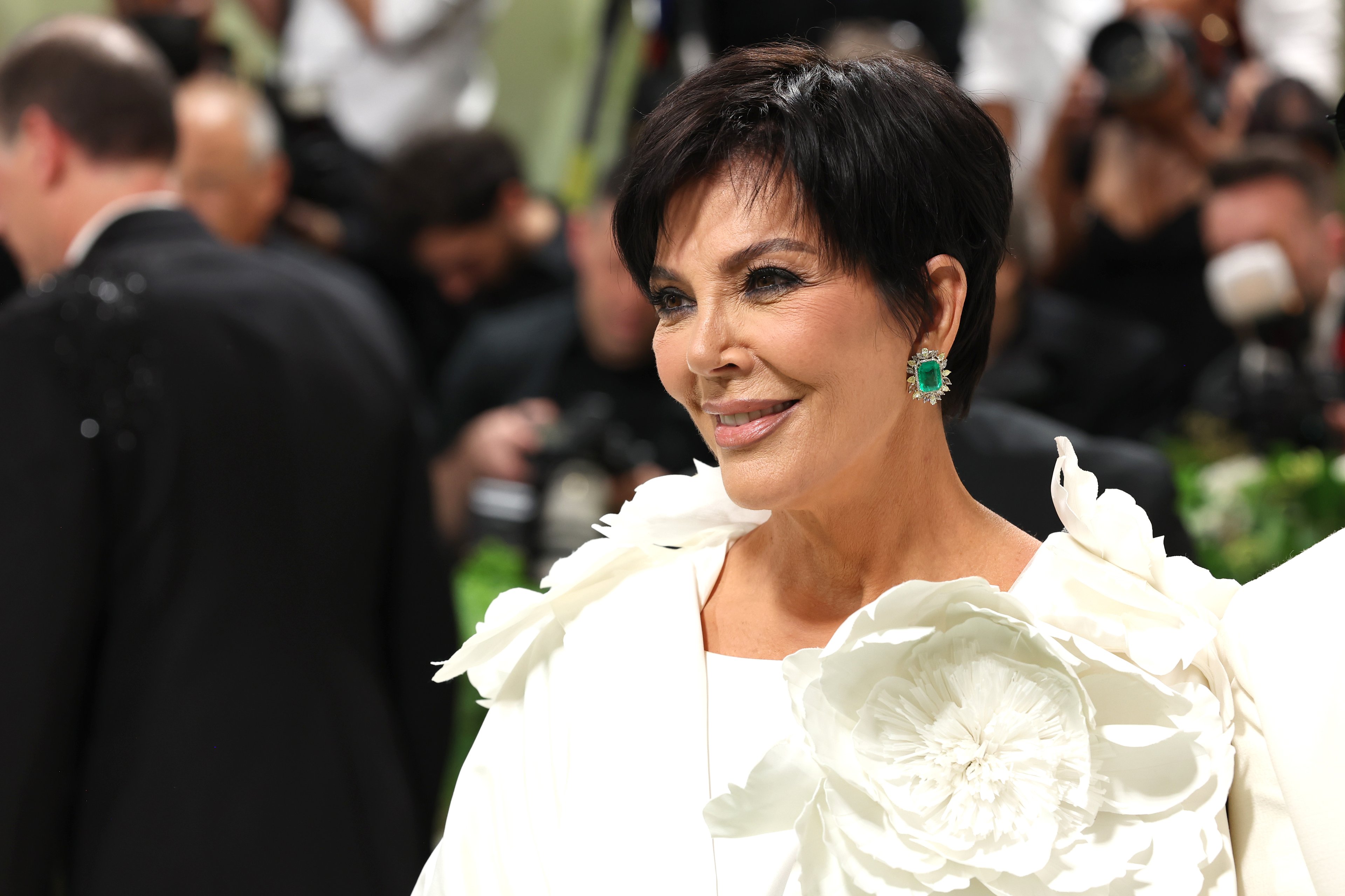 Entenda o procedimento que rejuvenesceu Kris Jenner e Donatella Versace; veja fotos