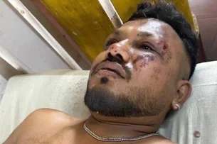'Ouvi um barulho alto e o avião caiu', relata sobrevivente de queda de aeronave na Índia