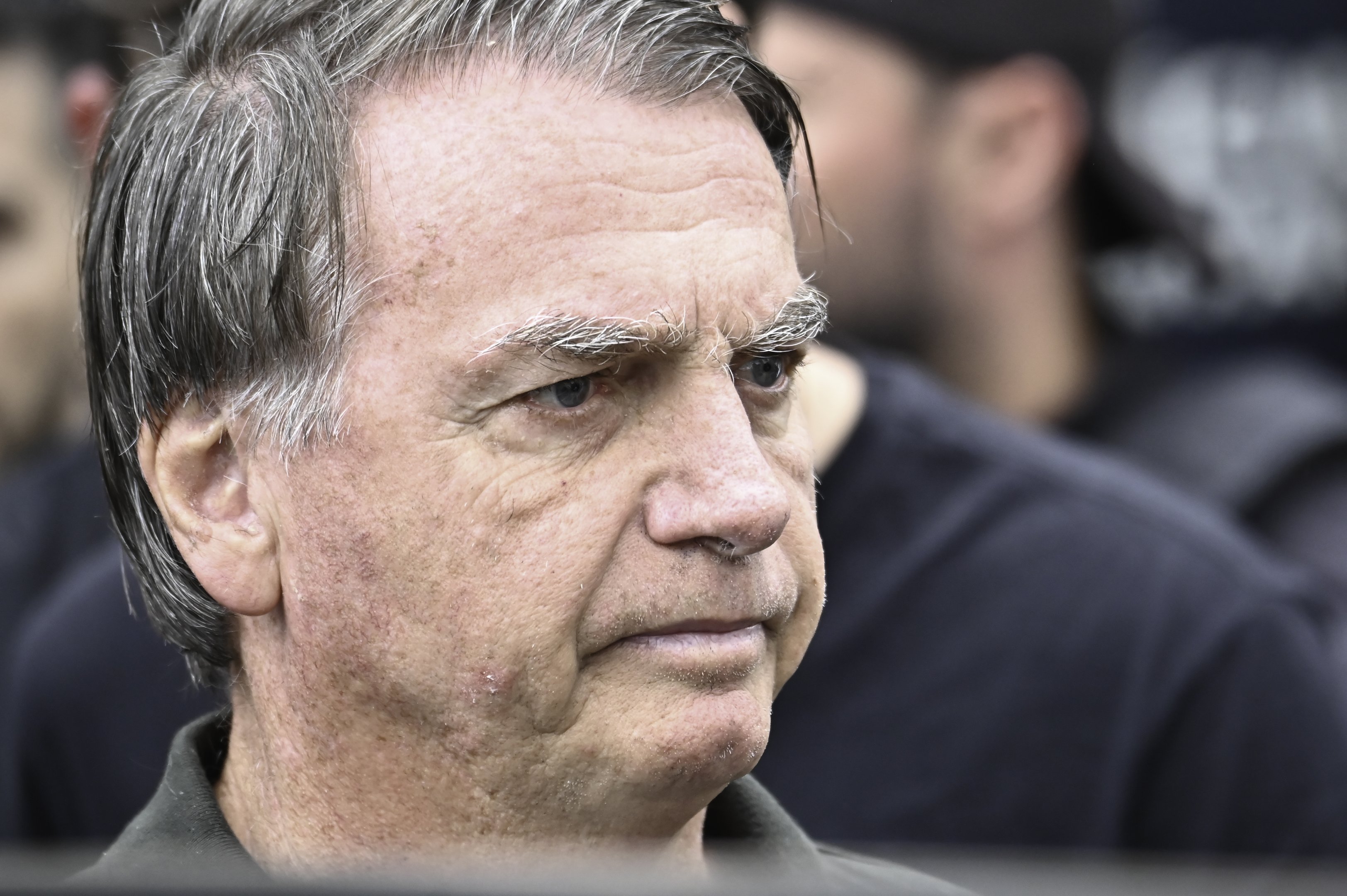 Prisão causa perplexidade e coloca saúde de Bolsonaro em risco, diz defesa