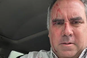 Imagem referente à matéria: Pré-candidato à presidência do Peru é alvo de ataque a tiros