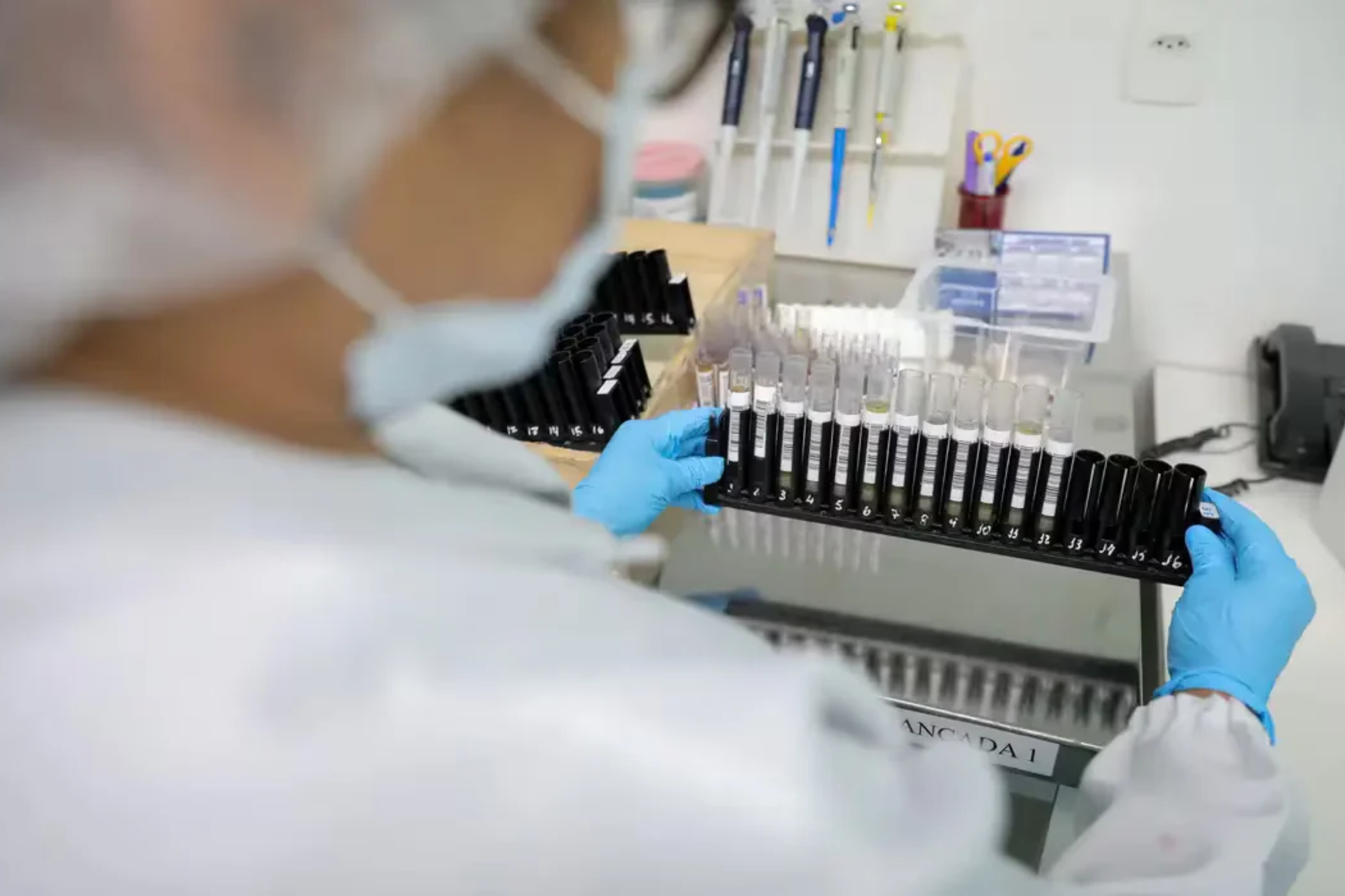 Anvisa autoriza testes humanos de vacina inédita contra malária
